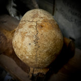 Human skull