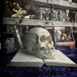 Medically prepared human skull