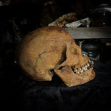 Human skull