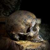 Human skull
