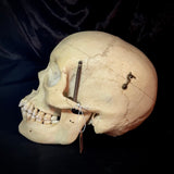 Item 5. Human medical skull