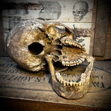 Human skull with mandible