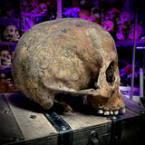 Human skull
