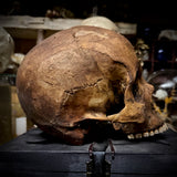 Human skull