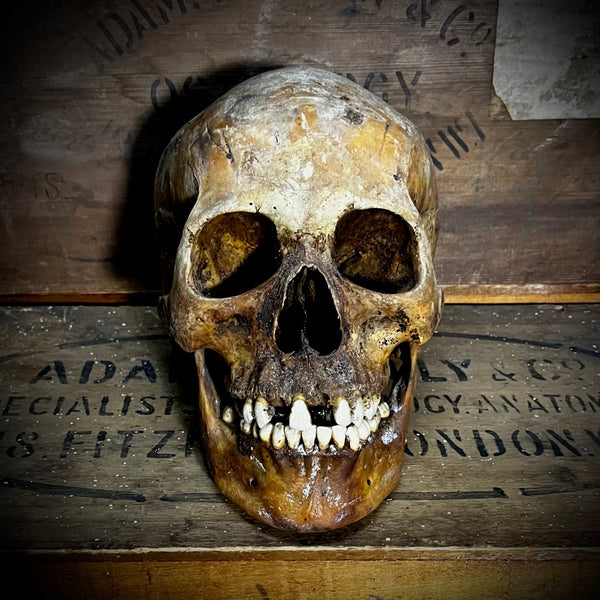 Human skull with mandible