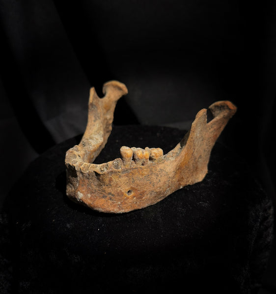 A mandible
