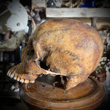 Human skull