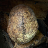 Human skull
