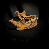 A mandible