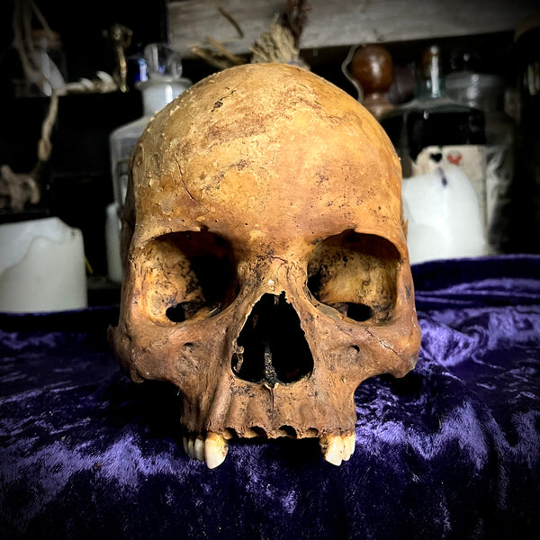 Human skull