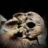 Human skull
