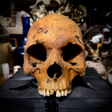 Human skull