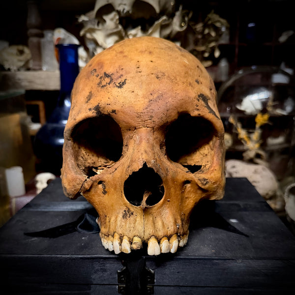 Human skull
