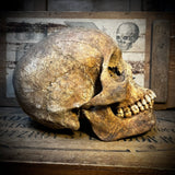 Human skull with mandible