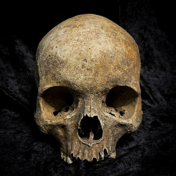 Human skull
