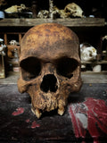 Human Skull