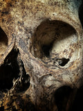 Human skull with mandible