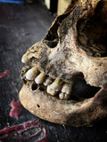 Human skull with mandible