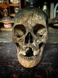 Human skull with mandible