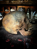 Human skull with mandible