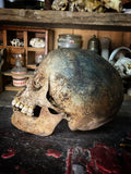 Human skull with mandible