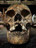 Human skull with mandible