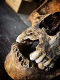 Human skull with mandible