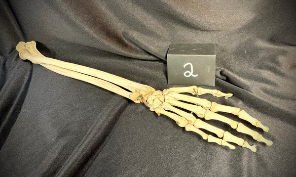 Item 2. Articulated human