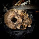 Human skull
