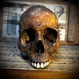 Human skull