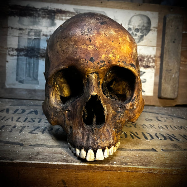Human skull