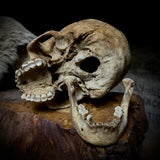 Human skull with mandible