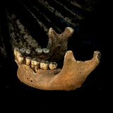 A mandible