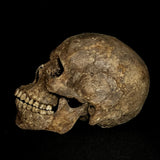 Item 5. Human skull with mandible