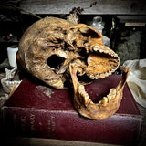 Human skull with mandible