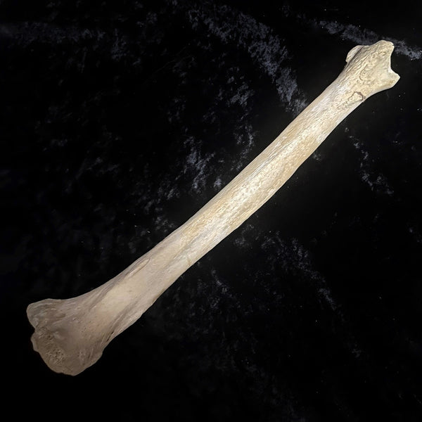 Human tibia (shinbone)