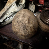 Human skull