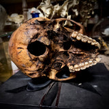 Human skull