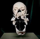 Adam Rouilly Exploded skull