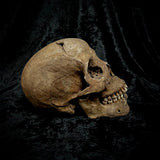 Machete wound skull