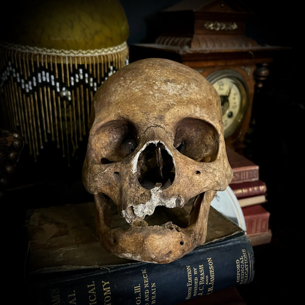 A human skull with mandible