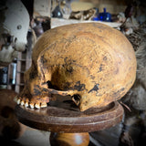 Human skull