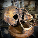 Human skull with mandible