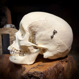 Medically prepared human skull
