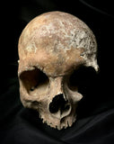 A human skull