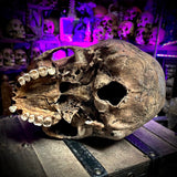Human skull