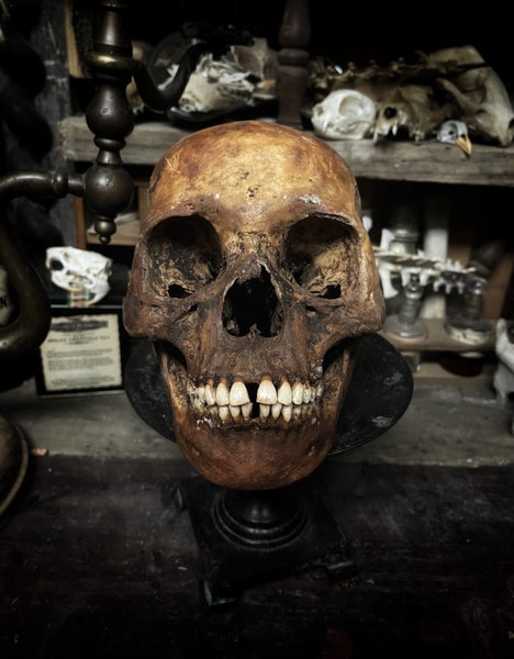 Human skull with mandible