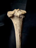 Human tibia (shinbone)