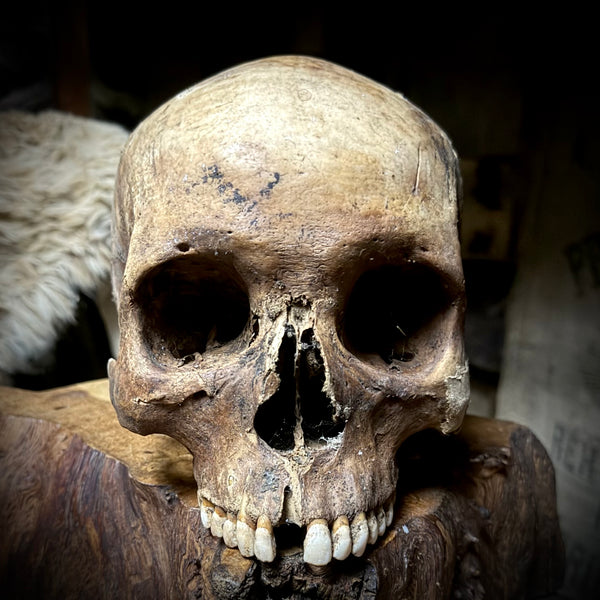 Human skull