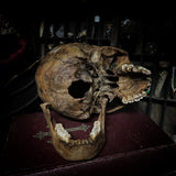 Human skull